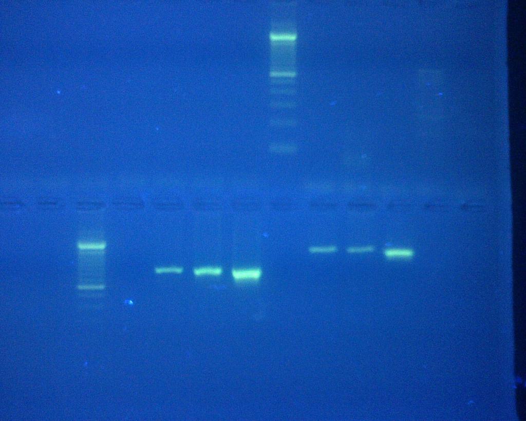 PCR factor eae H2O 513 524 EDL933 864pb gen eae H, Bohm H, Schmidt H,