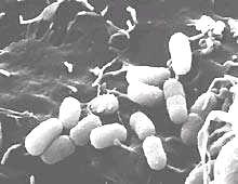 Eubiosis - Disbiosis La población bacteriana que vive en el tracto