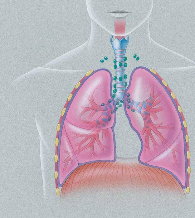El interior de los pulmones normales Para comprender cómo puede ayudarle la cirugía, es necesario que conozca, en primer lugar, las características anatómicas de los pulmones.