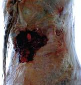 lesiones en la carcasa (res) encontradas en la playa de faena. Figura 2: Grado 2, afecta al tejido muscular (carne).
