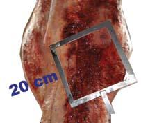 Región 2 (R2): se corresponde con las regiones anatómicas del tórax y del abdomen.