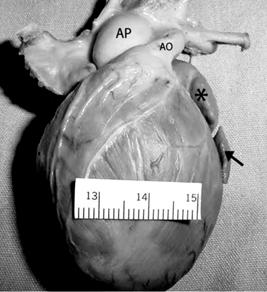 Se llevó a cabo el análisis segmentario del espécimen en situs solitus con levoposición del corazón.