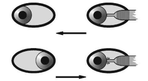 realice la versión izquierda. Si notamos tirón en la pinza en el movimiento de abducción del OI, indica que existe función del agonista, el recto lateral (fig. 9).