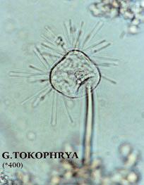 Fig. 13. Fotografía bajo 400 aumentos de un ciliado suctor del Género Tokophrya. Fig. 14. Imagen del rotífero del Género Keratella obtenida con microscopio óptico bajo 400 aumentos.
