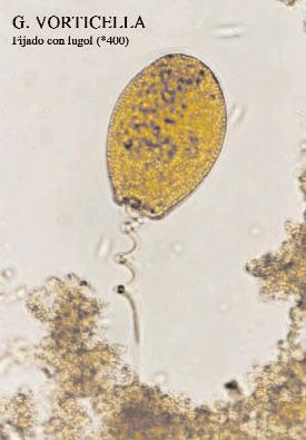 38 hecho constata la importancia de estos ciliados en el proceso de depuración, ya que estos microorganismos se localizan sobre la superficie de los flóculos, reptando sobre ellos y consumiendo las