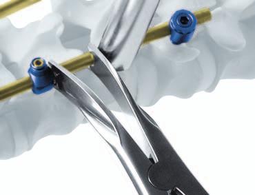 440 Anillo de Fijación 498.9 Separación o compresión Una vez introducida la barra y conectada a los implantes, puede realizarse la separación o compresión.