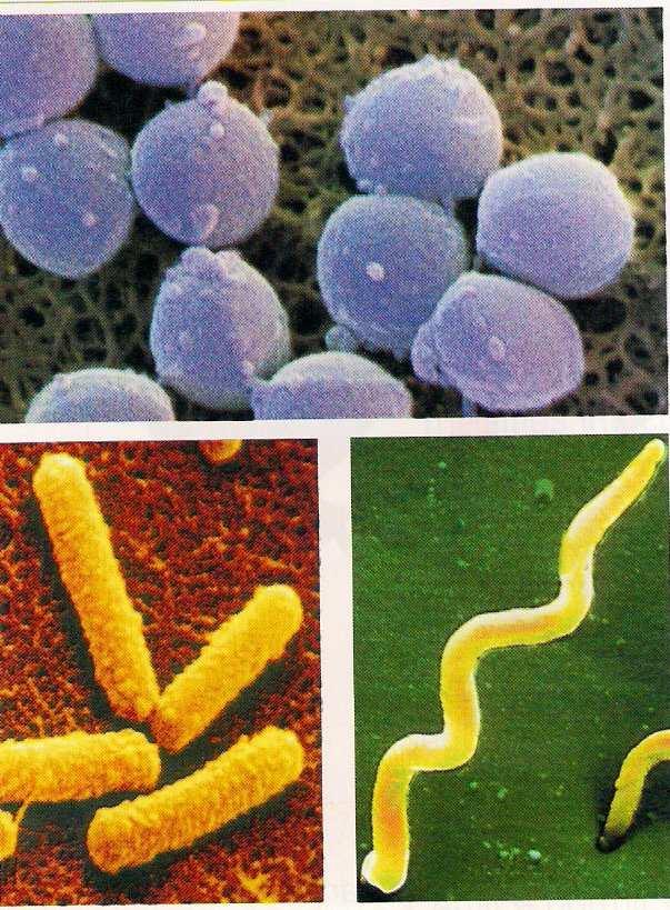 Microorganismes que causen malalties Els bacteris Els bacteris són éssers vius unicel lulars, tan petits que els hem d observar amb el microscopi electrònic.