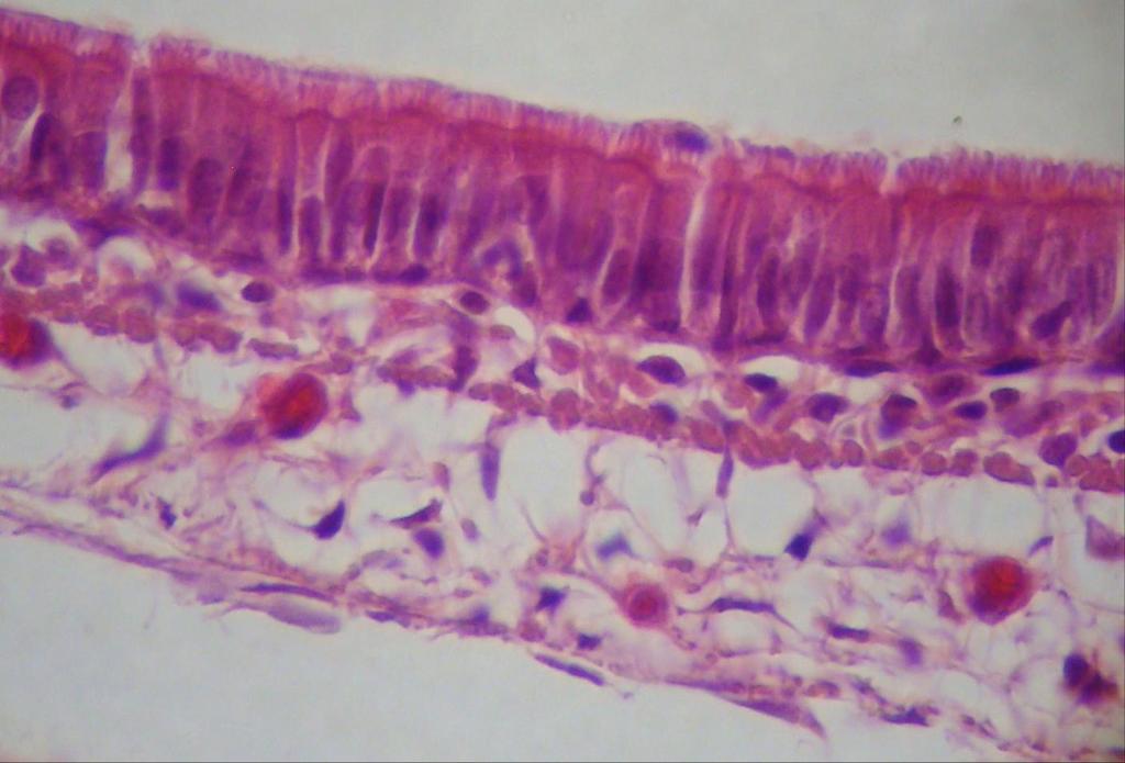 Epitelio columnar simple seudoestratificado con cilios (flecha) y epiteliocitos