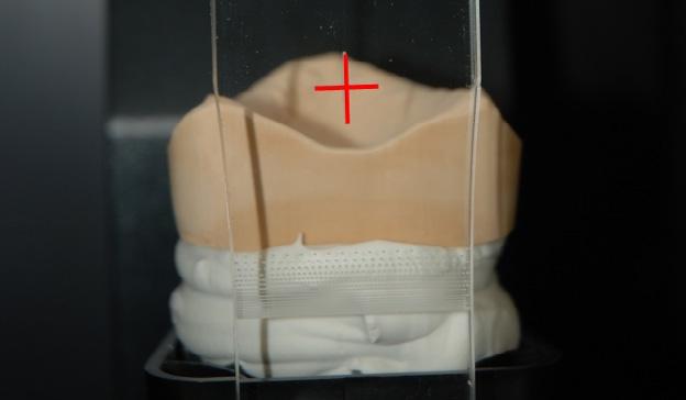 Durante el escaneado vestibular, en el Fixator solo deben encontrarse los modelos de los dos maxilares.