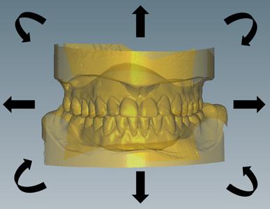 7. Diseño de prótesis totales con el Ceramill Mind El módulo CAD para prótesis totales Ceramill D-Flow es una ampliación del software básico Ceramill Mind, y se necesita para diseñar prótesis totales.