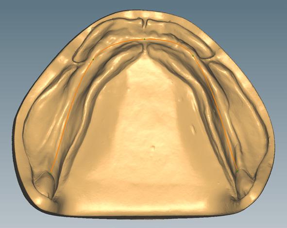 Determinación de la línea media de la cresta alveolar en el maxilar inferior Definir: La trayectoria de la línea media de la cresta alveolar en el maxilar inferior se genera automáticamente.