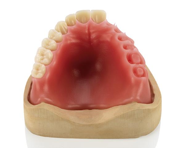 11.5. Montaje de las bases y los dientes Antes de montar los dientes en la base se hace una primera colocación de prueba para comprobar su ajuste en las bolsas. Img.