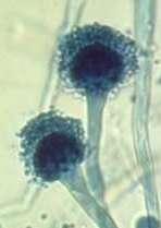 llamadas basidios esporangios zigosporas Ascosporas Deuteromycetes Poseen