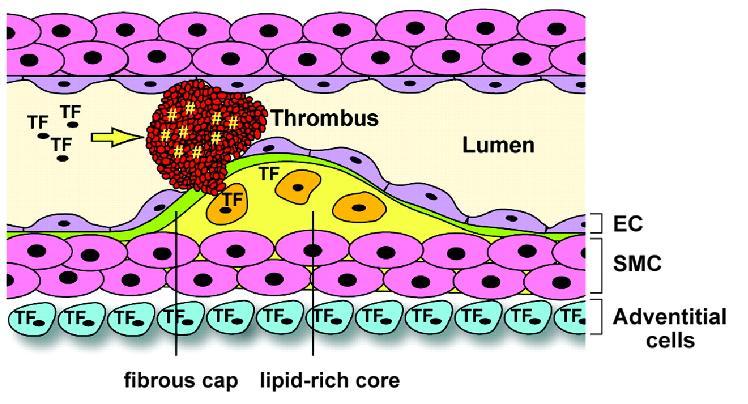 TROMBINA +++ FT FT FTFT FT FT INFLAMACION FT Trombo Luz vascular Endotelio Celulas musculares