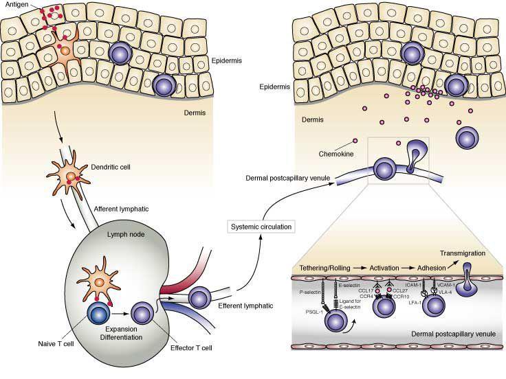Mecanismo de sensibilización Pérdida de continuidad Penetración del microorganismo Células de Langerhans se activan y producen IL1 Fijan