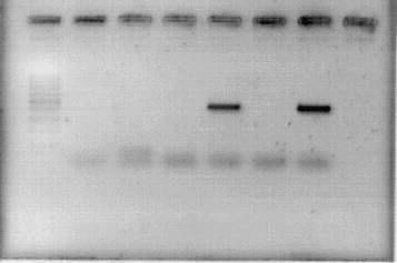 Staphylococcus aureus 1 2 3 4 5 6 7 8 Luk-PV Caracterización feno-genotípica de cepas de Staphylococcus aureus
