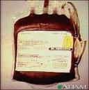 Transmisión humano-humano Humano Transfusiones