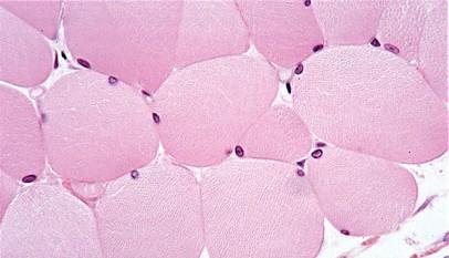 Núcleos se encuentran en un citoplasma altamente estructurado y rodeado por una gruesa