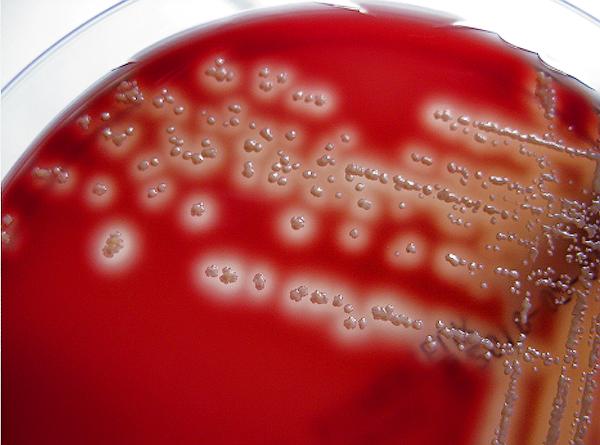 Figura 2. Colonias beta-hemolíticas, pleomórficas, mucoides y amarillentas tras dos días de incubación en agar sangre a 37 C.