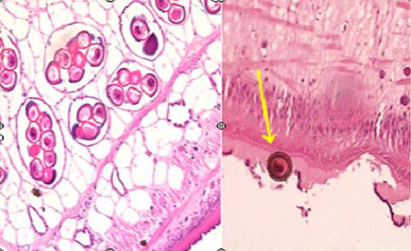 Figura 2. Corte histológico. Tinción con hematoxilina-eosina (200 x). Qué sabes de esta parasitosis? D.