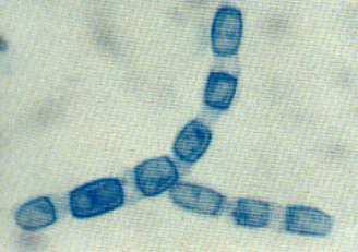 Cultivos a 28 y 37 C: micelio aéreo blanquecino Micelio ramificado hialino con