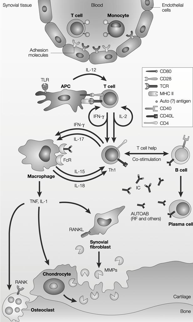Patogenia y daño Articular en AR Reclutamiento de leucocitos en la sinovial inflamada Inducción de producción de citoquinas inflamatorias (ej, IL-1, IL-6) Sintesis aumentada de metaloproteinasas;