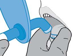 Prueba de ajuste. Enjuague la plantilla de attachment en agua fría y pruebe su ajuste en la boca del paciente. Aislamiento de los dientes para el cementado.