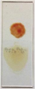 malaria Coloración de Extendido y Gota Gruesa (Coloración de Giemsa Modificada) Reactivos y materiales * Amortiguador