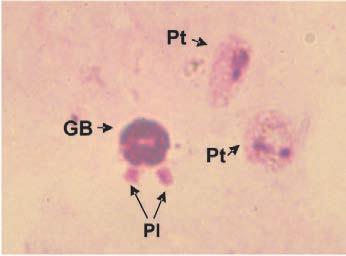 A Figura 10. Plasmodium vivax Manual diagnóstico demalaria GOTA GRUESA B C Extendidos GB: Glóbulo blanco. GR: Glóbulo rojo no infectado. PL: Plaqueta.