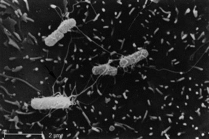 Escherichia coli Eschericia coli