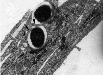 Eschericia coli Invadiendo las células