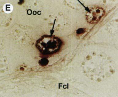 Salud y prevención de enfermedades Hibridacion in situ Foto de un ovocito