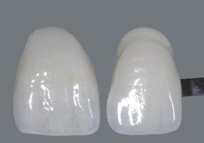 La comparación con un diente de muestra de la VITA Toothguide 3D-MASTER permite controlar el resultado.