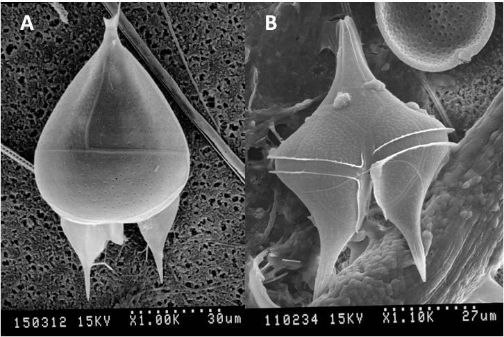 Lámina 8. A. Micrografía MEB de Podolampas sp., B. Micrografía MEB de Protoperidinium sp.bahía Salinas, Guanacaste.