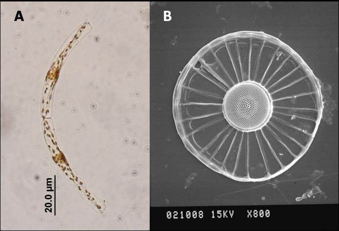 Especie: Guinardia sp. Peragallo, 1892 Descripción: Diatomeas cilíndricas, que pueden formar cadenas, neríticas u oceánicas.