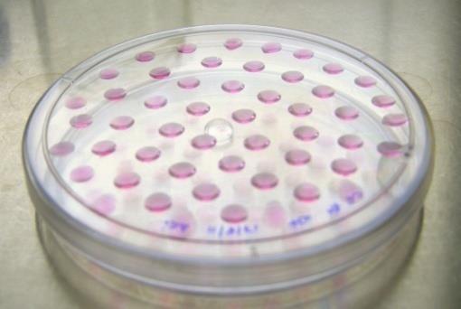Diferenciación in vitro de CME Formación de Cuerpos Embrioides por Hanging Drop Células cultivadas sobre gelatina Medio