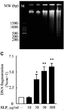 Endothelial Citotoxicity induced by TRL 40 p<0.