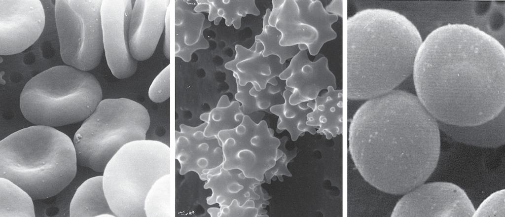 Glóbulos rojos Glóbulos rojos en una solución isotónica no cambian de volúmen. La porción fluida de la sangre es isotónica en relación con el citoplasma.