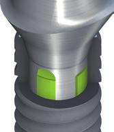 Fiabilidad y flexibilidad: unión cónica La CrossFit Connection posee un cono para mejorar las propiedades mecánicas y ofrecer más flexibilidad en el tratamiento prostodóncico.