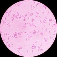 Campylobacter características generales Familia Campylobacteriaceae (1991) Campylobacter (campylo=