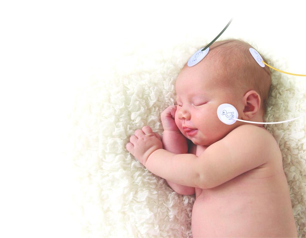 DESCRIPCIÓN DE LA TÉCNICA Hoy en día la hipoxia isquémica cerebral es la principal causa de perdida neuronal en recién nacido.