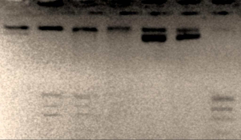 1 2 3 4 5 6 7 Figura 3: Digestión ADN genómico y control por Epi MSPI y Epi Hpa II 1-4 ADN genómico (Muestra 12) y PUC 19 desmetilado; 5, 6