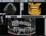 X-VIEW 3D PAN Trident introduce la más alta tecnología CBCT -Cone Beam Computed Tomographypara la adquisición de imágenes volumétricas de