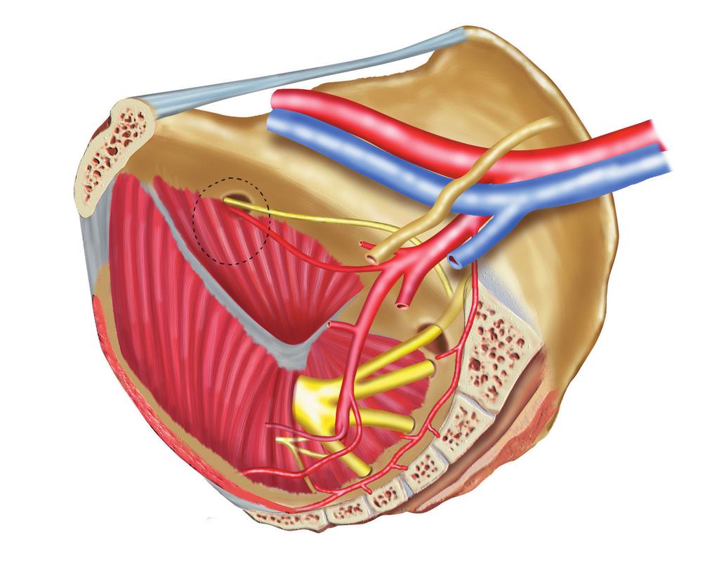 ATLAS de Incontinencia Urinaria y Suelo Pélvico Canal obturatriz Nervio obturador Vasos iliacos Ureter Agujero obturador Figura 1: Paso transobturatorio de la aguja para