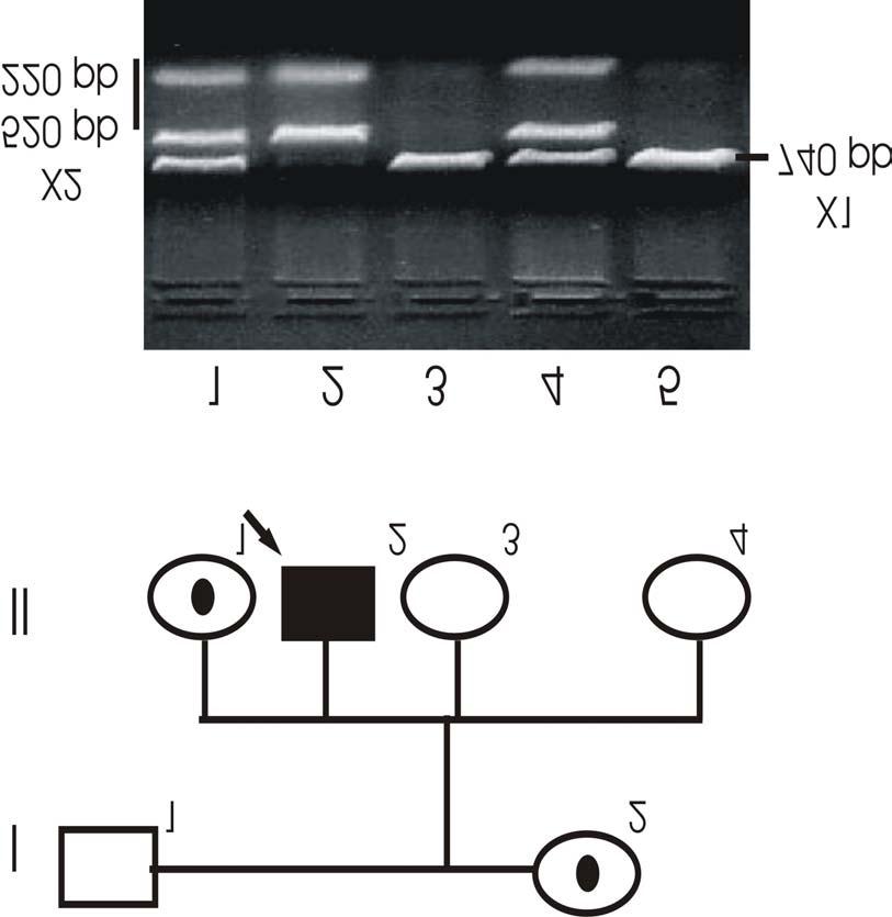 Figura 21. Asignación y exclusión del alelo mutado por medio de pert87.15/xmni en una familia sin mutación caracterizada y con antecedentes de la enfermedad.