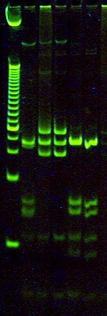 TP 3: Detección de RFLPs (Restriction Fragment Lenght Polymorphisms) en el ADN mitocondrial.