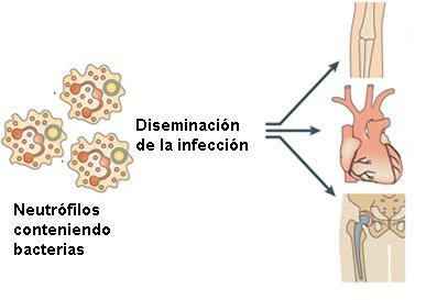 Troya Vacuola con bacterias Formación de fagolisosoma Destrucción de
