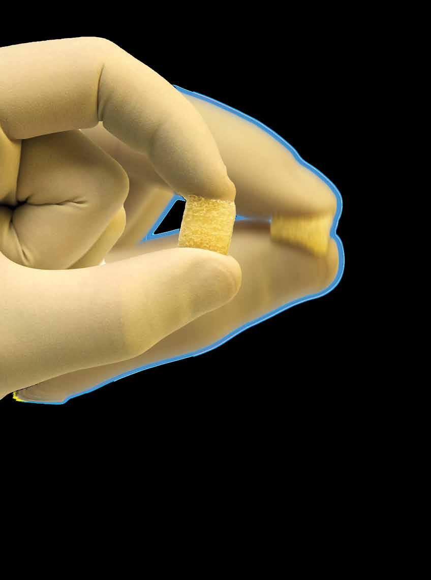 BioSponge es un implante derivado de tejido óseo humano, es estéril y está libre de pirógenos.