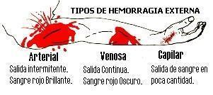 TIPOS DE HEMORRAGIAS: