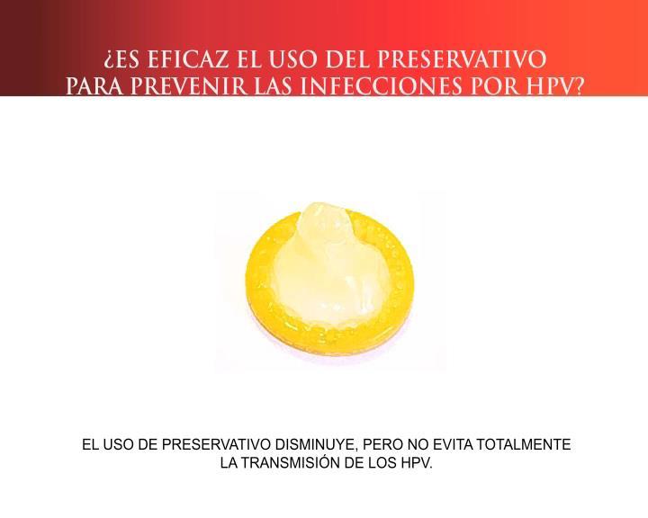 EL USO DEL PRESERVATIVO DISMINUYE PERO NO EVITA TOTALMENTE LA TRANSMISIÓN DEL HPV.